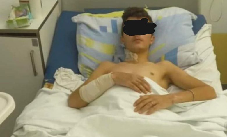 مأساة مهاجر مغربي في صربيا.. شهيد يكشف هوية الشرطيين المتورطين في بتر ساقيه مأساة مهاجر مغربي في صربيا.. شهيد يكشف هوية الشرطيين المتورطين في بتر ساقيه
