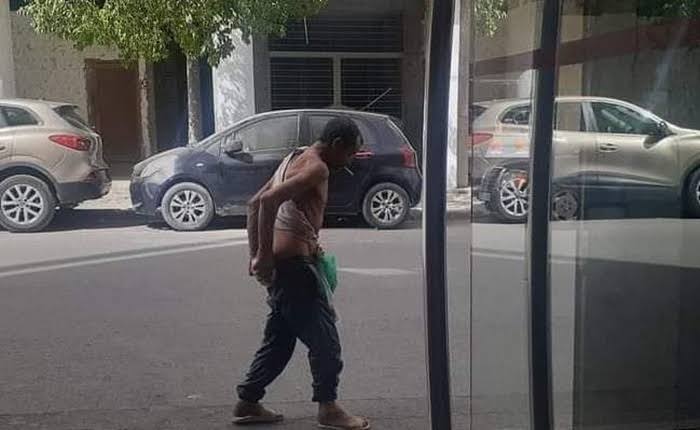 نقل طفل إلى مستعجلات فاس بعد اعتداء بحجر من مختل عقلي بتازة